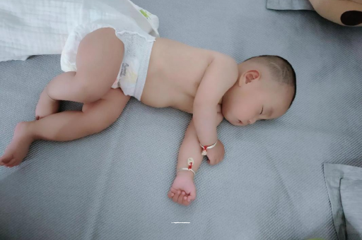 海门六个月宝宝眼睛散光